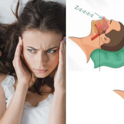 Zusammenhang zwischen Sinusitis und Schnarchen