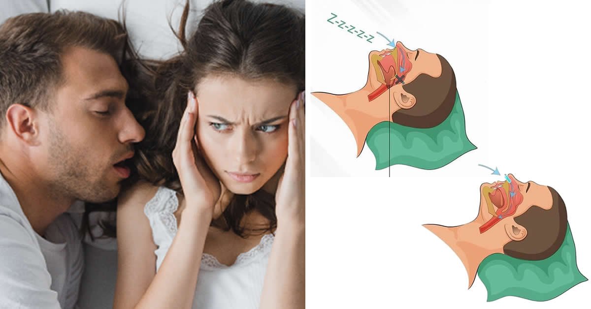 sinusitis and snoring